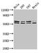 CD3e Molecule Associated Protein antibody, CSB-PA004932LA01HU, Cusabio, Western Blot image 