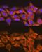 Suppressor Of Cytokine Signaling 2 antibody, GTX03238, GeneTex, Immunocytochemistry image 