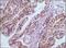 Glutathione S-Transferase Pi 1 antibody, GTX83077, GeneTex, Immunohistochemistry paraffin image 