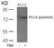 Protein Kinase C Delta antibody, GTX50314, GeneTex, Western Blot image 