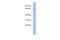 Ribonucleoprotein, PTB Binding 2 antibody, A12771, Boster Biological Technology, Western Blot image 