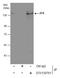 Zinc Finger Protein X-Linked antibody, GTX130761, GeneTex, Immunoprecipitation image 