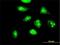 NOP16 Nucleolar Protein antibody, H00051491-B01P, Novus Biologicals, Immunocytochemistry image 