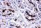 CF Transmembrane Conductance Regulator antibody, PA2201, Boster Biological Technology, Immunohistochemistry frozen image 