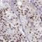 SIX Homeobox 6 antibody, HPA001403, Atlas Antibodies, Immunohistochemistry paraffin image 