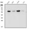 Growth Factor Receptor Bound Protein 7 antibody, A02528, Boster Biological Technology, Western Blot image 