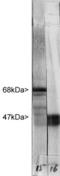 Neurofilament Light antibody, LS-B10417, Lifespan Biosciences, Western Blot image 