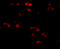 Transmembrane Protein 18 antibody, 5043, ProSci, Immunofluorescence image 