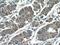 Ras GTPase-activating-like protein IQGAP2 antibody, 55189-1-AP, Proteintech Group, Immunohistochemistry paraffin image 