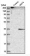 Sirtuin 5 antibody, NBP1-86013, Novus Biologicals, Western Blot image 