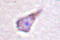 WASP antibody, LS-C176481, Lifespan Biosciences, Immunohistochemistry frozen image 