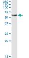 Ectodysplasin A Receptor antibody, H00010913-M01, Novus Biologicals, Western Blot image 