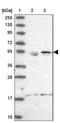CCZ1 Homolog, Vacuolar Protein Trafficking And Biogenesis Associated antibody, NBP2-46711, Novus Biologicals, Western Blot image 