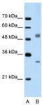 Interferon Regulatory Factor 6 antibody, TA332092, Origene, Western Blot image 