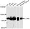 Interleukin 17 Receptor E antibody, LS-C749321, Lifespan Biosciences, Western Blot image 