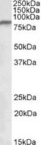 NADH:Ubiquinone Oxidoreductase Core Subunit S1 antibody, NBP1-52060, Novus Biologicals, Western Blot image 