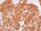 Glucose-6-Phosphate Isomerase antibody, GTX113203, GeneTex, Immunohistochemistry paraffin image 