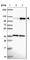 ATPase Phospholipid Transporting 8A1 antibody, HPA052935, Atlas Antibodies, Western Blot image 