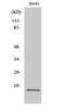 Single Stranded DNA Binding Protein 1 antibody, STJ95791, St John