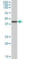 Zinc Finger Protein 83 antibody, H00055769-B01P, Novus Biologicals, Western Blot image 