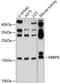 RB Binding Protein 9, Serine Hydrolase antibody, GTX64865, GeneTex, Western Blot image 