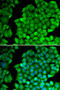 Cyclin D2 antibody, 14-888, ProSci, Immunofluorescence image 