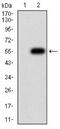 Cholinergic Receptor Nicotinic Delta Subunit antibody, NBP2-61733, Novus Biologicals, Western Blot image 