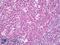 Adhesion Regulating Molecule 1 antibody, LS-B7353, Lifespan Biosciences, Immunohistochemistry paraffin image 