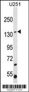 Suppression Of Tumorigenicity 5 antibody, 62-197, ProSci, Western Blot image 