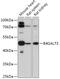 Beta-1,4-Galactosyltransferase 3 antibody, 16-988, ProSci, Western Blot image 