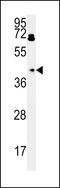 Pyruvate Dehydrogenase E1 Alpha 1 Subunit antibody, LS-C156782, Lifespan Biosciences, Western Blot image 