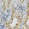 DNA Topoisomerase II Alpha antibody, LS-C368772, Lifespan Biosciences, Immunohistochemistry paraffin image 