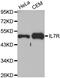 Interleukin 7 Receptor antibody, MBS126422, MyBioSource, Western Blot image 