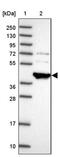 TNF Alpha Induced Protein 8 Like 3 antibody, PA5-61725, Invitrogen Antibodies, Western Blot image 