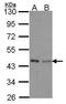 Isovaleryl-CoA dehydrogenase, mitochondrial antibody, GTX114502, GeneTex, Western Blot image 