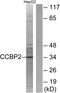 Atypical Chemokine Receptor 2 antibody, A30785, Boster Biological Technology, Western Blot image 