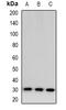 Testis Specific Serine Kinase 6 antibody, orb382502, Biorbyt, Western Blot image 