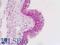 Endothelin Receptor Type B antibody, LS-B8981, Lifespan Biosciences, Immunohistochemistry paraffin image 