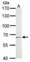 Lysine Acetyltransferase 5 antibody, PA5-29457, Invitrogen Antibodies, Western Blot image 