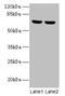 Synaptotagmin Like 3 antibody, CSB-PA687190LA01HU, Cusabio, Western Blot image 