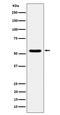 Target Of EGR1, Exonuclease antibody, M09852, Boster Biological Technology, Western Blot image 