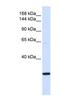 Structural Maintenance Of Chromosomes 2 antibody, NBP1-52932, Novus Biologicals, Western Blot image 