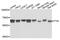 FYN Proto-Oncogene, Src Family Tyrosine Kinase antibody, abx136103, Abbexa, Western Blot image 