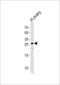 Coiled-Coil Domain Containing 90B antibody, LS-C168442, Lifespan Biosciences, Western Blot image 