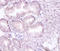 Proteasome 26S Subunit, Non-ATPase 11 antibody, LS-C211225, Lifespan Biosciences, Immunohistochemistry paraffin image 