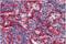 Major Histocompatibility Complex, Class I, E antibody, GTX11820, GeneTex, Immunohistochemistry paraffin image 