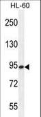 Endo-Beta-N-Acetylglucosaminidase antibody, LS-C167757, Lifespan Biosciences, Western Blot image 