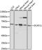 DDB1 And CUL4 Associated Factor 11 antibody, A15519, ABclonal Technology, Western Blot image 