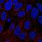 Tetratricopeptide Repeat Domain 6 antibody, NBP2-49592, Novus Biologicals, Immunocytochemistry image 