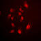 SMAD Family Member 4 antibody, LS-C352478, Lifespan Biosciences, Immunofluorescence image 